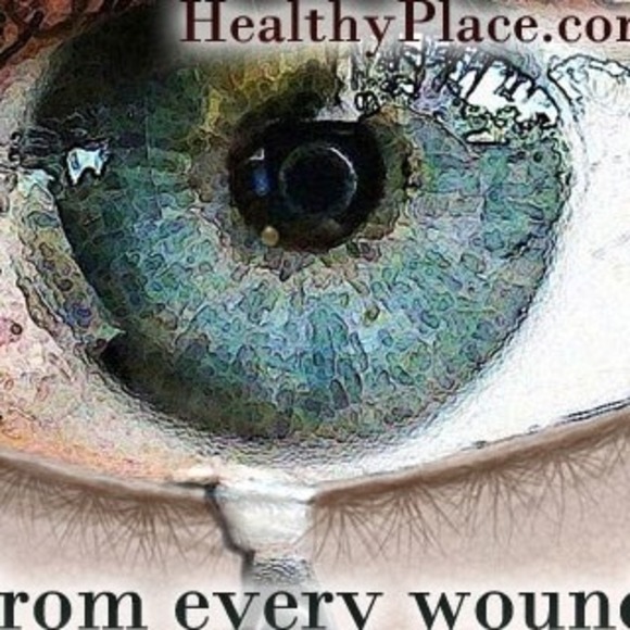 Meet your Posher, Robin - Picture 1 of 1